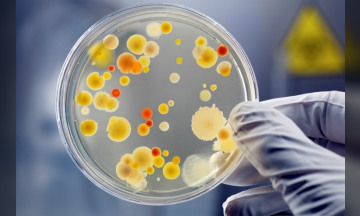 Berbagai Penyakit Yang Diakibatkan Oleh Bakteri Staphylococcus Aureus