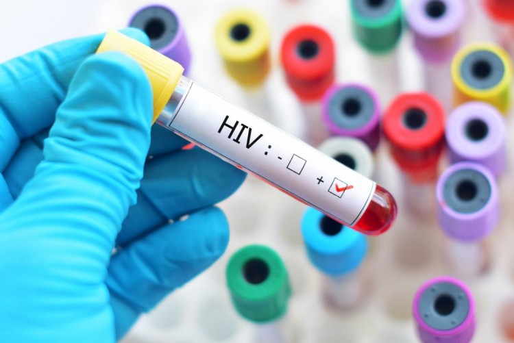 Ngobrol HIV/AIDS bareng hayVeeID dan Skisoblu