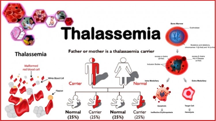 Mengenal Lebih Dekat Dengan Thalassemia